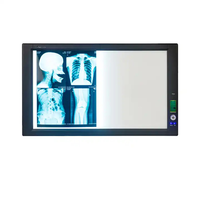 Película azul de rayos X médicos para impresoras de inyección de tinta con alta nitidez y poca niebla