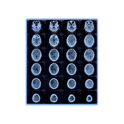 Película azul de inyección de tinta para impresión gráfica de rayos X médicos