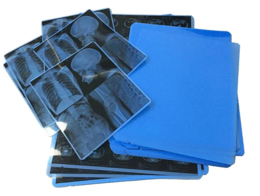 Película azul de rayos X médicos para impresoras de inyección de tinta y imágenes claras y precisas