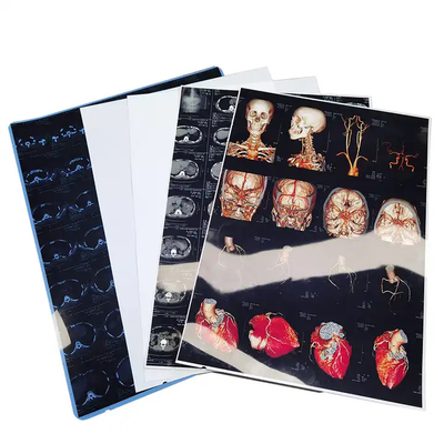 Película seca médica de inyección de tinta Película de rayos X azul transparente para el dispositivo radiológico de tomografía computarizada DR MRI