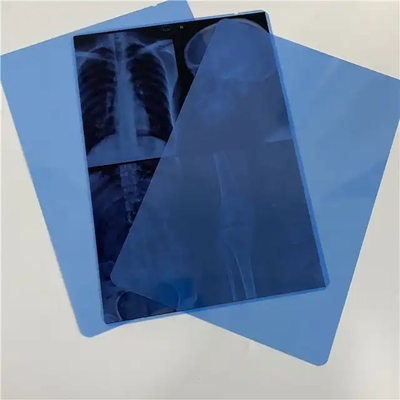 Impresión por inyección de tinta PET Seco láser de rayos X Película de base azul transparente para diagnóstico por imágenes