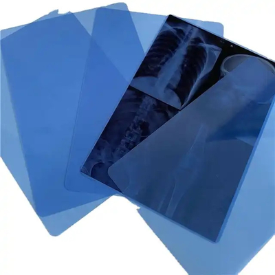 Impresión por inyección de tinta PET Seco láser de rayos X Película de base azul transparente para diagnóstico por imágenes