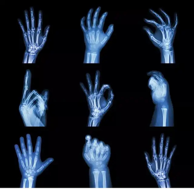 Impresión por inyección de tinta PET Seco láser de rayos X Película de base azul transparente para diagnóstico por imágenes