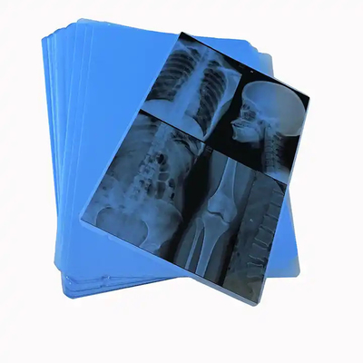 Imágenes médicas con película de rayos X de inyección de tinta térmica a base de PET azul para hospitales clínicos