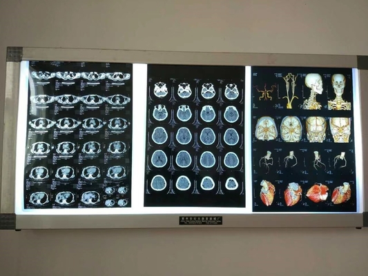 Imagen de película seca de rayos X a prueba de agua para dispositivos médicos Impresión por inyección de tinta láser