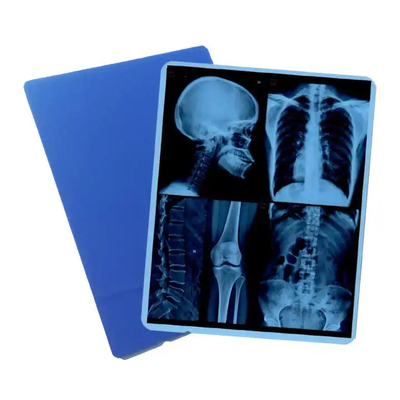 Sistema de imágenes médicas con película seca láser de rayos X para DR CR MRI Impresora de rayos X con ISO CE