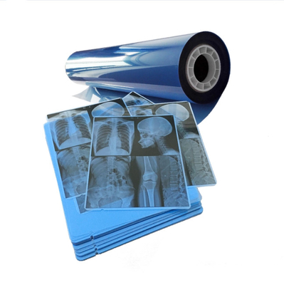 Jato de tinta de película médica azul para obtener resultados consistentes de imágenes de rayos X