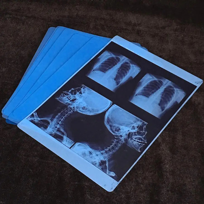 Película de rayos X médica de inyección de tinta compatible con Canon HP y Epson Impresora de película de inyección de tinta