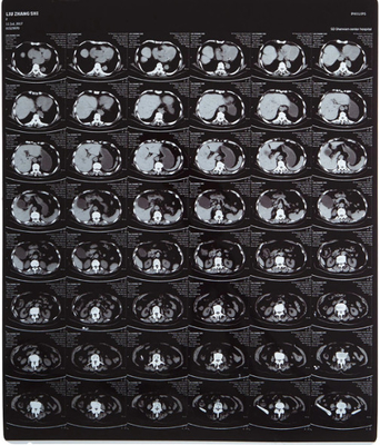 Película médica de rayos X de alta claridad FUJI DIHT 14*17in Película de imagen seca con láser