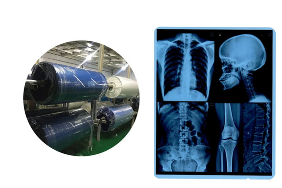 Rollo de película de rayos X médica de inyección de tinta Base azul para CR DR CT IRM salida de imagen