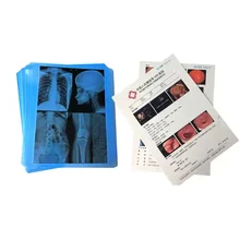 Jato de tinta de película médica de alta resolución para imágenes de diagnóstico claras y detalladas