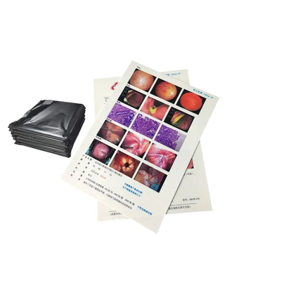 Base de película PET Azul transparente de color películas médicas de rayos X para diagnóstico de rayos X
