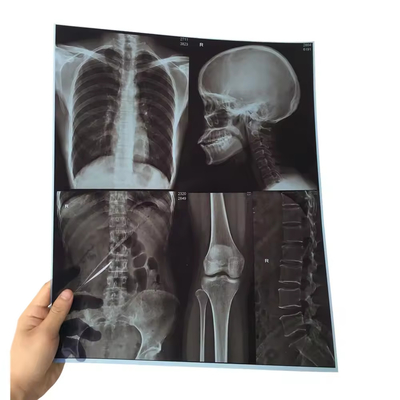 Película de rayos X de Pix seco Fuji DIHL Rayos X Médico Imagen por láser seco Película de rayos X