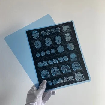 Película seca médica de rayos X con calidad de imagen clara