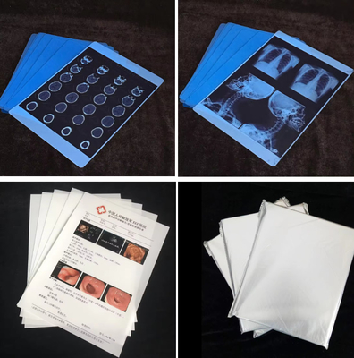 Película de rayos X médica de inyección de tinta compatible con Canon HP y Epson Impresora de película de inyección de tinta