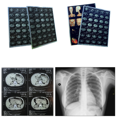 Hojas de tamaño A4 Película médica de inyección de tinta azul para imágenes médicas