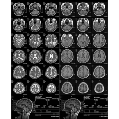 Película médica de rayos X de uso único ajustada automáticamente a la densidad