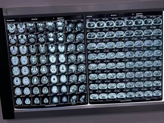Película automática de densidad de rayos X para equipos médicos