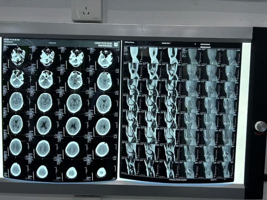 Película de rayos X láser de diagnóstico mejorado de densidad 0.28D para equipos médicos