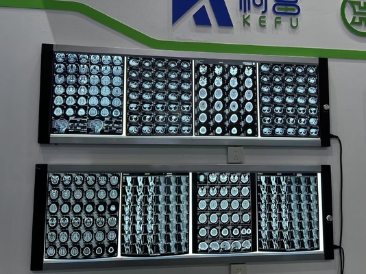 Película médica automática para la densidad de rayos X ajustable con láser de imágenes de cristal resultados claros