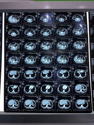 Equipo médico Película de impresión térmica láser de densidad azul de rayos X