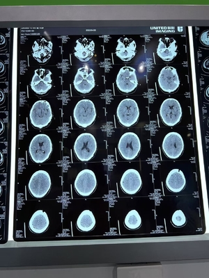 3.0D Contraste Superior Flexibilidad Película de Rayos X Seca con láser para uso médico
