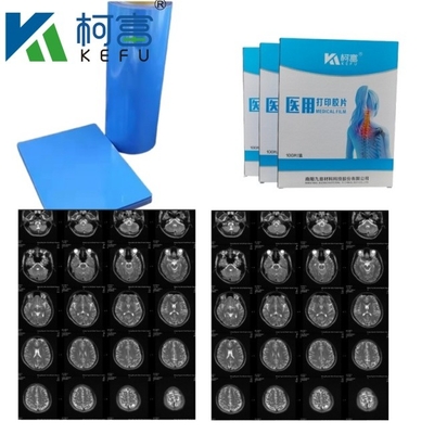 Imagen médica CT DR Tinta de chorro Película azul de rayos X médica Película PET A4