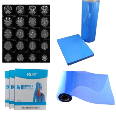 Película de rayos X PET de alta nitidez para la fabricación de dispositivos médicos
