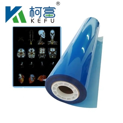 Película de rayos X médica de fábrica Azul Película de rayos X médica sensible