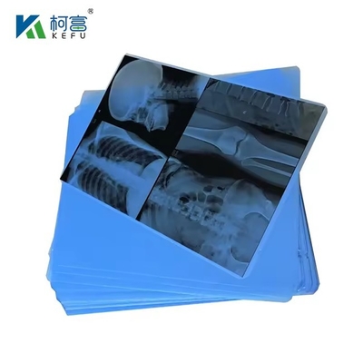 Tinta médica A4 Película azul de chorro Película PET de rayos X Papel de rayos X