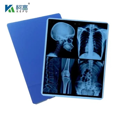Película de imagen seca de inyección de tinta azul médica Película de base azul para hacer película de rayos X Impresoras Epson HP