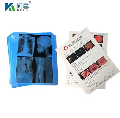 CT Scanner Seco de rayos X 24x30 pulgadas de película de inyección de tinta verde azul base de radiografía médica