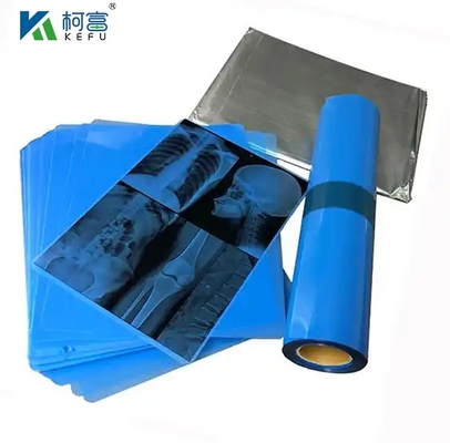 Imágenes médicas con película térmica/de inyección de tinta de rayos X a base de PET azul para clínicas y hospitales