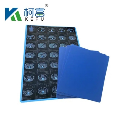 A3 Hojas de tamaño personalizado Rollos Película médica de inyección de tinta azul para impresión de imágenes médicas CT, CR, DR, MTR