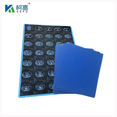 Radiología Película médica PET de inyección de tinta seca azul 8x10 10x12 11x14 14x17 pulgadas Películas médicas ortopédicas de rayos X