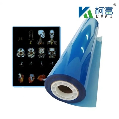 Imagen médica azul de rayos X de película seca del hospital CT Imagen médica de inyección de tinta a prueba de agua