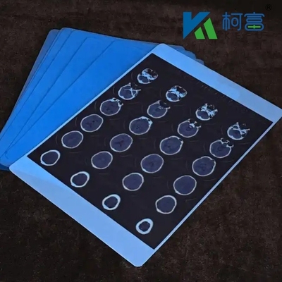 Imagen médica azul de rayos X de película seca del hospital CT Imagen médica de inyección de tinta a prueba de agua
