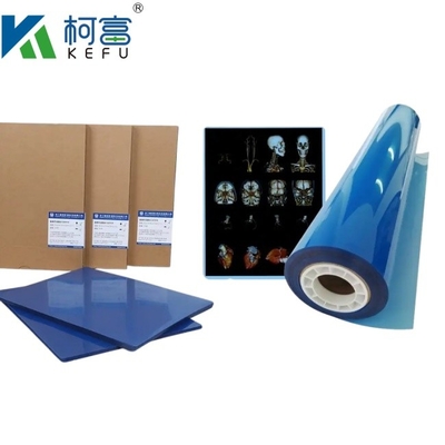 Tamaño personalizado 35x43 Jato de tinta Azul de la película de rayos X médicos para Epson A4 PET Seco azul láser médico rayos X