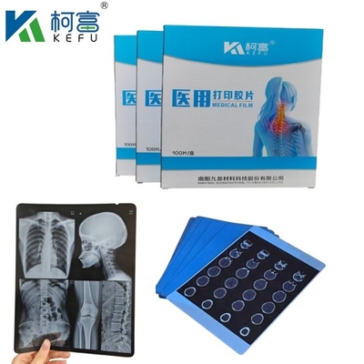 Tamaño personalizado Tinta de inyección de luz azul de rayos X para Epson A4 A3 PET Seco azul láser médico de rayos X en venta