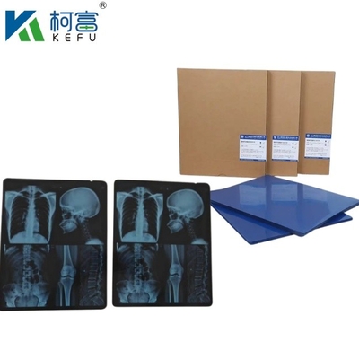 Tamaño personalizado Tinta de inyección de luz azul de rayos X para Epson A4 A3 PET Seco azul láser médico de rayos X en venta