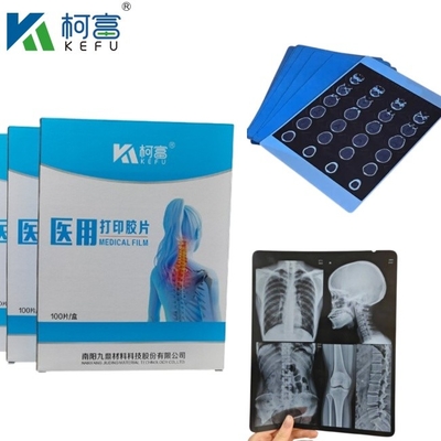 Tamaño personalizado Imágenes médicas de tinta de rayos X basadas en PET azul / película láser para clínicas y hospitales