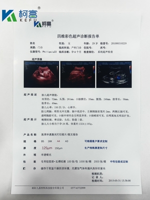 Película seca médica transparente de inyección de tinta Película de rayos X blanca para el dispositivo radiológico CT DR MRI