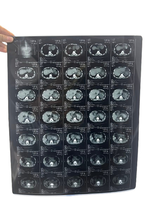 Impresión por inyección de tinta de rayos X de tinta seca de rayos X para dispositivos médicos