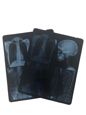 Película seca de rayos X médica de alta nitidez espesor de capa protectora 200±5 μm