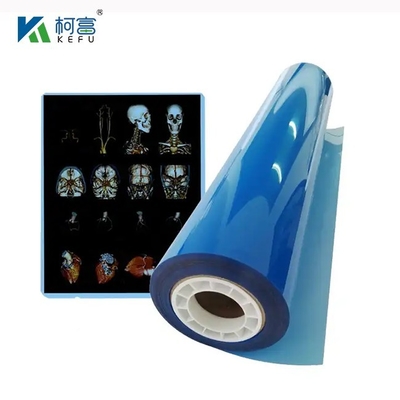 Película de rayos X médica Película de inyección de tinta para impresora de inyección de tinta Película de rayos X blanca azul