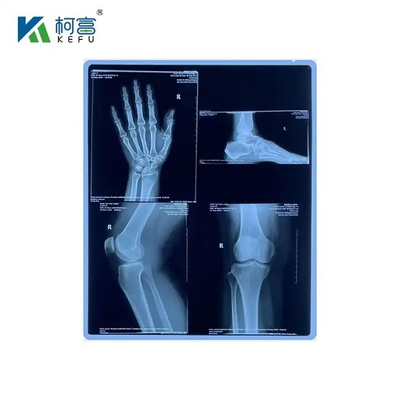 Película láser médica de larga duración y bajo mantenimiento 16x21in 0.17mm manteniendo la calidad de imagen durante períodos prolongados con un mantenimiento mínimo