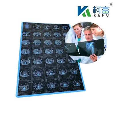 125 micrones Semi - láser blanco transparente X - Ray PET de plástico de películas médicas diseñadas para exceder en medicina
