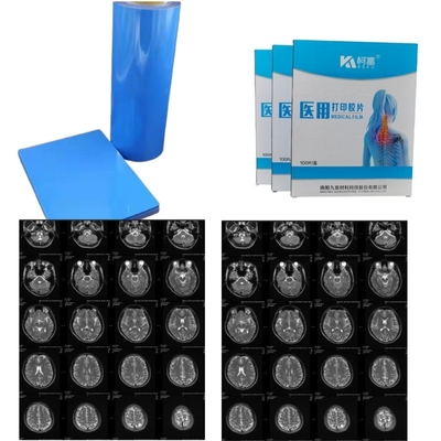 Imagen médica de PET seco de inyección de tinta láser de rayos X 14x17 pulgadas