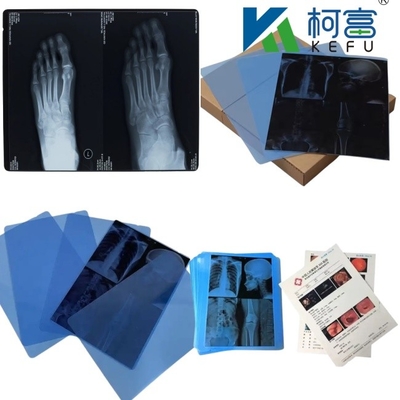 14*17 pulgadas de película de escaneo en seco para radiografías médicas/CT/DR para impresoras de imágenes láser de rayos X y equipos de impresoras térmicas