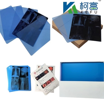 Tamaño personalizado Película de rayos X médica de inyección de tinta azul y blanca para impresoras de inyección de tinta en hojas